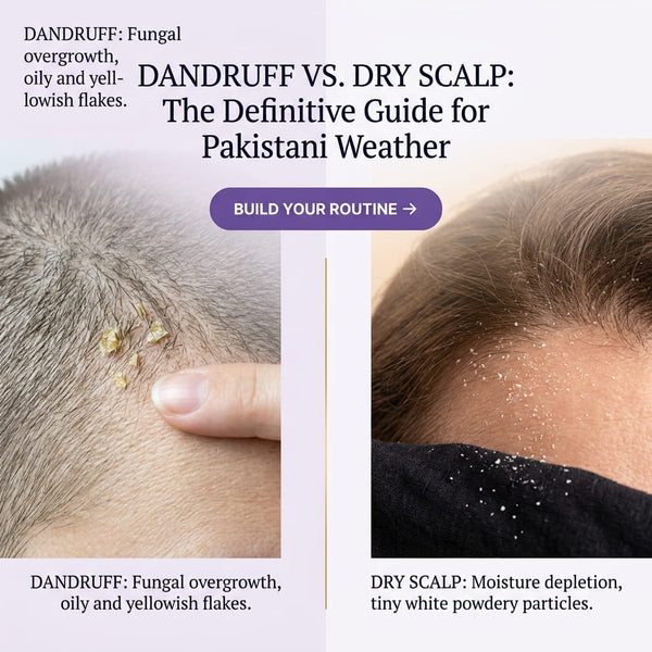 Dandruff vs Dry Scalp in Pakistan: How to Tell the Difference and Fix the Flakes