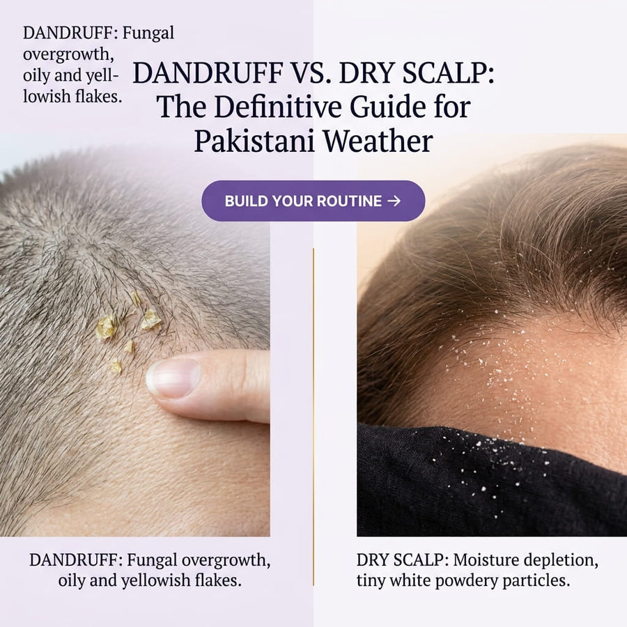Dandruff vs Dry Scalp in Pakistan: How to Tell the Difference and Fix the Flakes