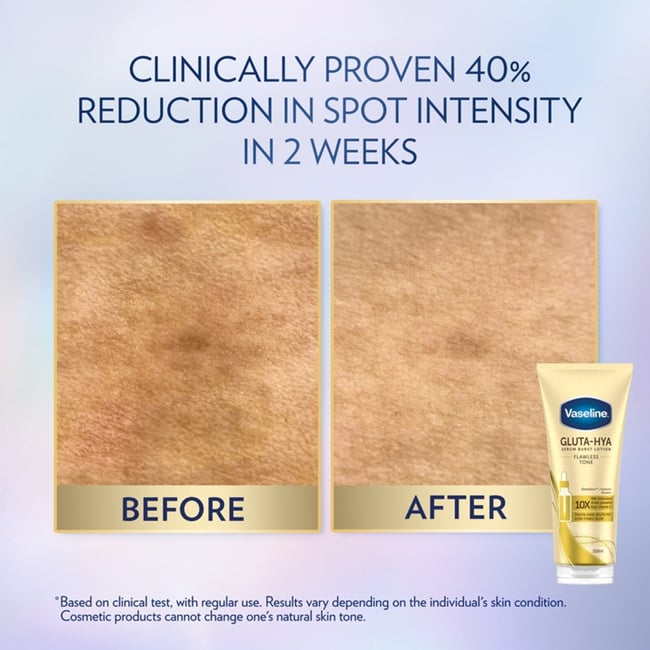 Vaseline Gluta-Hya Serum Burst Lotion Flawless Bright